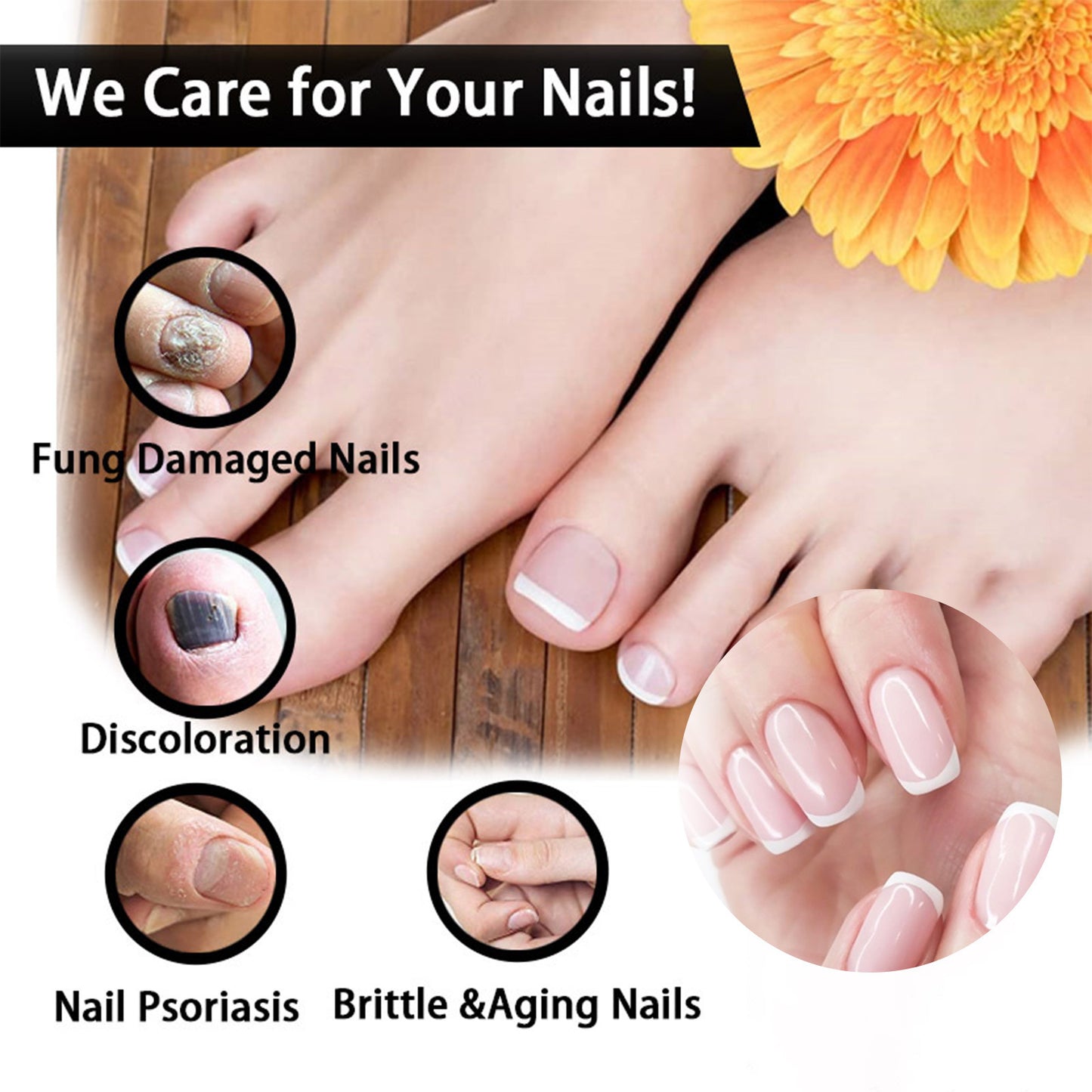 EELHOE Nail Repair Solution