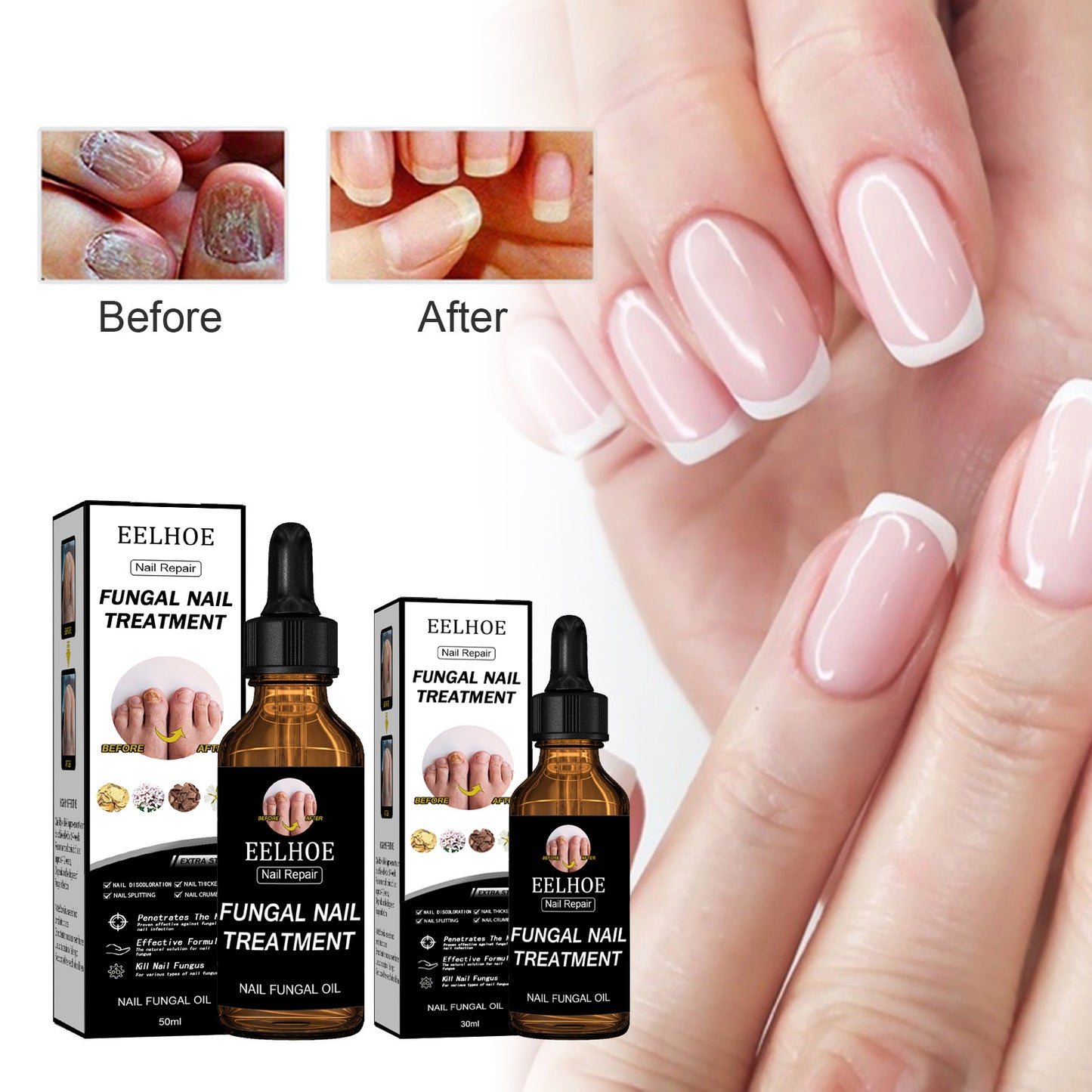 EELHOE Nail Repair Solution